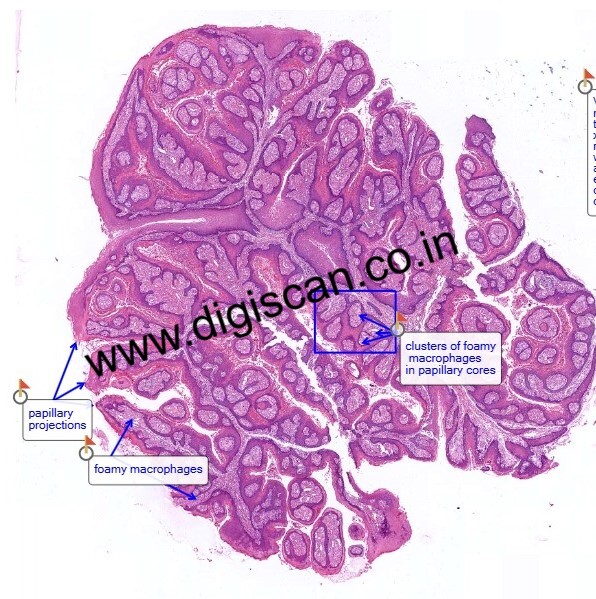 MDS Oral Pathology Exam Cases (Digital Slides & Spot Diagnosis)